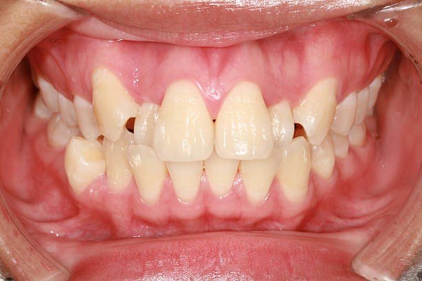 How Orthodontics Realigns the Face and Teeth